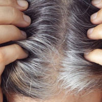 Nguyên nhân khiến tóc bạc sớm ở người trẻ