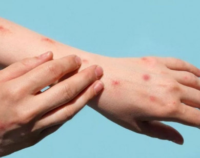 Bổ sung 12 bệnh vào danh mục bệnh truyền nhiễm nhóm A, B