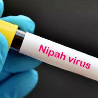 Bộ Y tế chỉ đạo các bệnh viện siết chặt kiểm soát người nhập cảnh