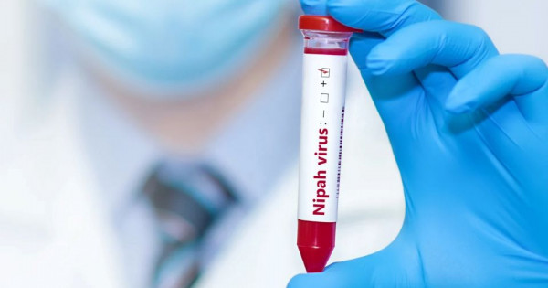 Quy trình xét nghiệm và xác định ca bệnh nhiễm virus Nipah theo hướng dẫn mới