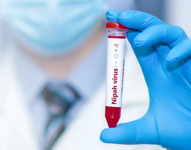 Quy trình xét nghiệm và xác định ca bệnh nhiễm virus Nipah theo hướng dẫn mới