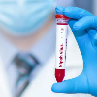 Quy trình xét nghiệm và xác định ca bệnh nhiễm virus Nipah theo hướng dẫn mới