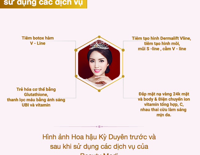 1-hoa-hậu-nói-dối-kỳ-duyên