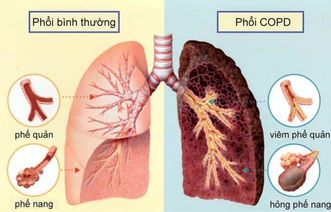 Mô tả ảnh