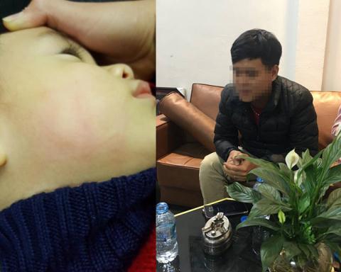 Bé trai 22 tháng tuổi bị bác sĩ tát sưng mặt khi đang khám bệnh