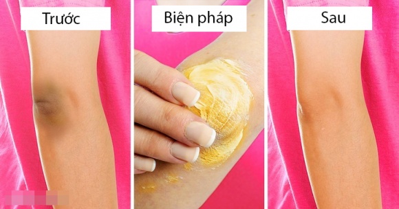 trị thâm 