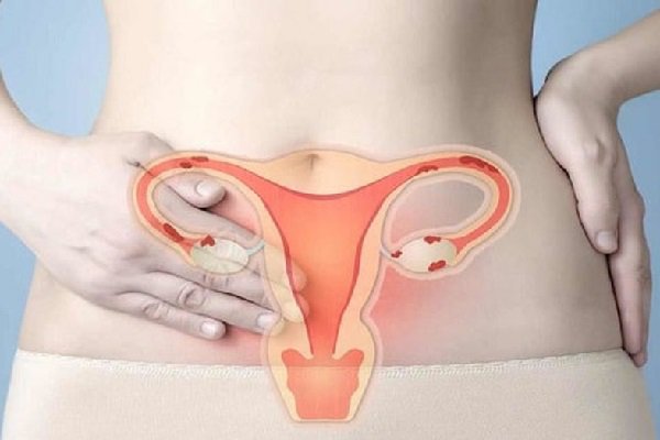 Gần 5.000 phụ nữ được xét nghiệm sàng lọc miễn phí ung thư cổ tử cung