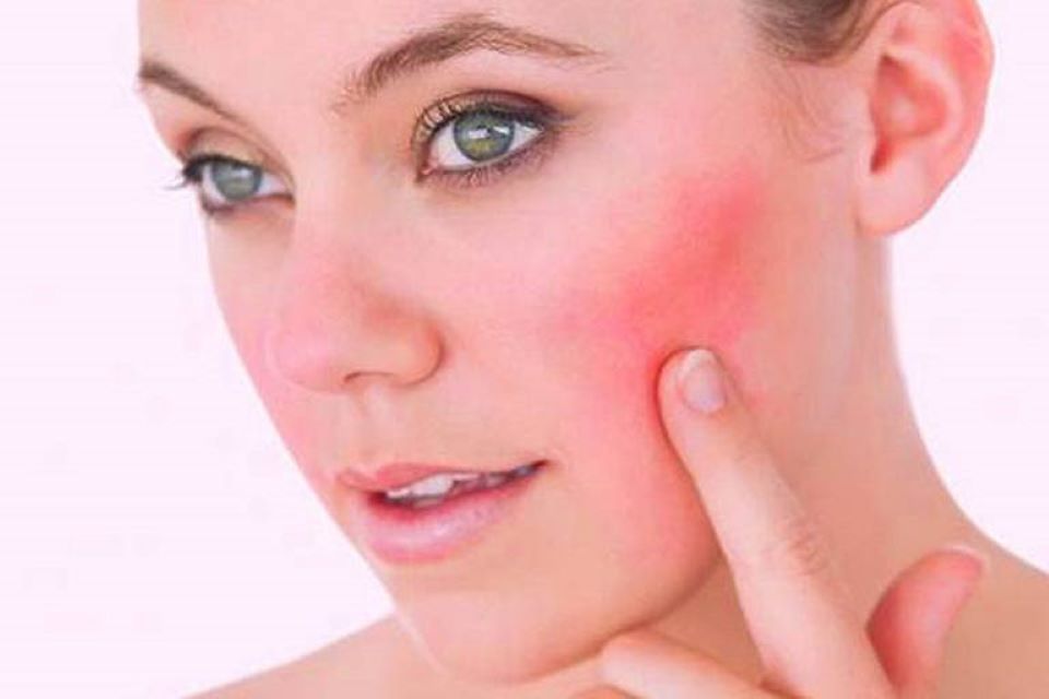 Biến chứng nguy hiểm khi dùng mặt nạ dưỡng da sai cách, kém chất lượng