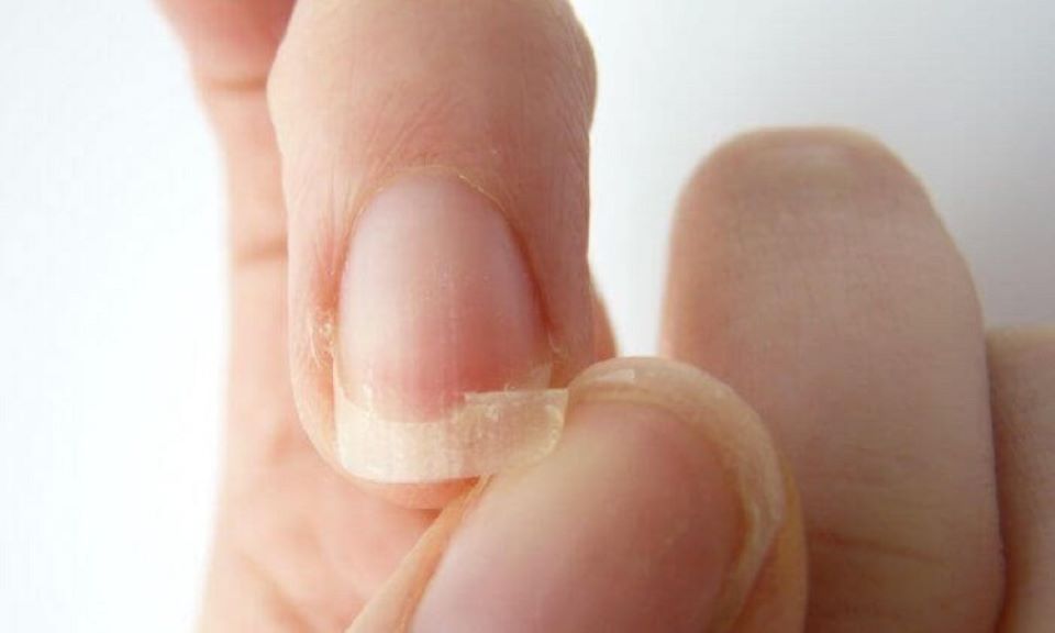 Những dấu hiệu cảnh báo cơ thể thiếu canxi nghiêm trọng