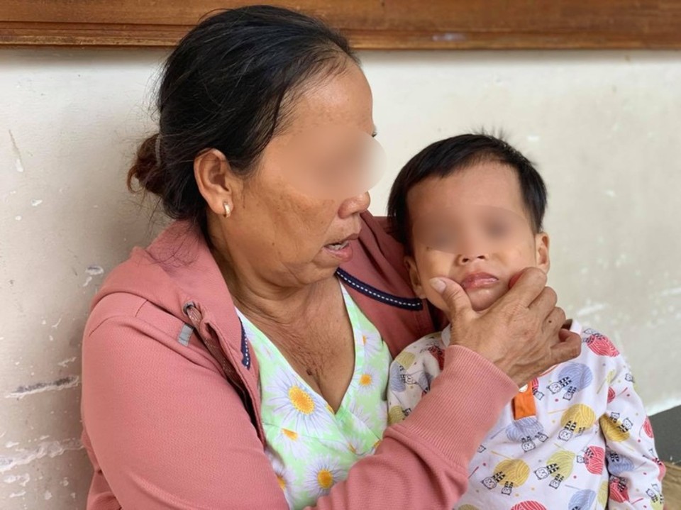 Bé gái 3 tuổi nghi bị mẹ ruột đánh chấn thương sọ não