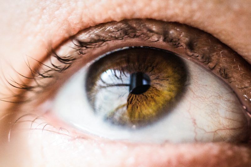 Dấu hiệu bất thường ở mắt tiết lộ về sức khỏe của bạn