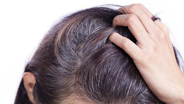 4 giải pháp hàng đầu ngăn ngừa tóc bạc sớm