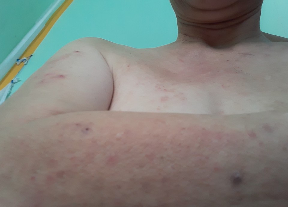 Người tiêu dùng “tố” ăn gạo mầm Vibigaba của Lộc Trời có vị đắng và gây ngứa?