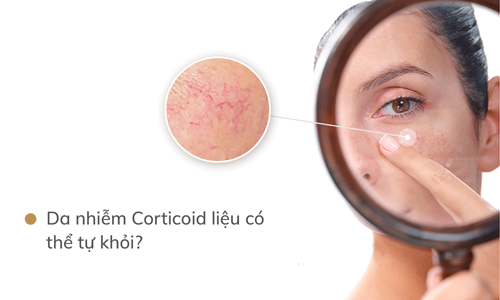 Bí quyết khôi phục da nhiễm Corticoid hiệu quả nhất hiện nay