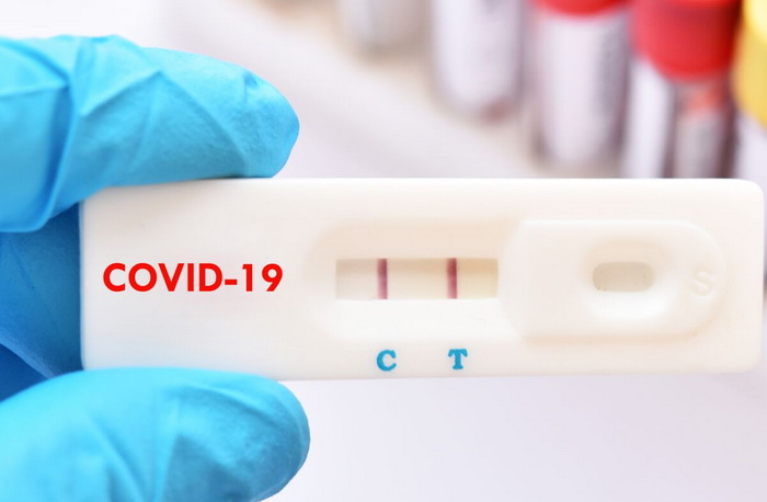 Tự test nhanh Covid-19 lên "2 vạch" cần làm gì?