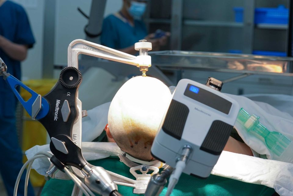 Vinmec tiên phong điều trị động kinh bằng Robot định vị thần kinh hàng đầu thế giới