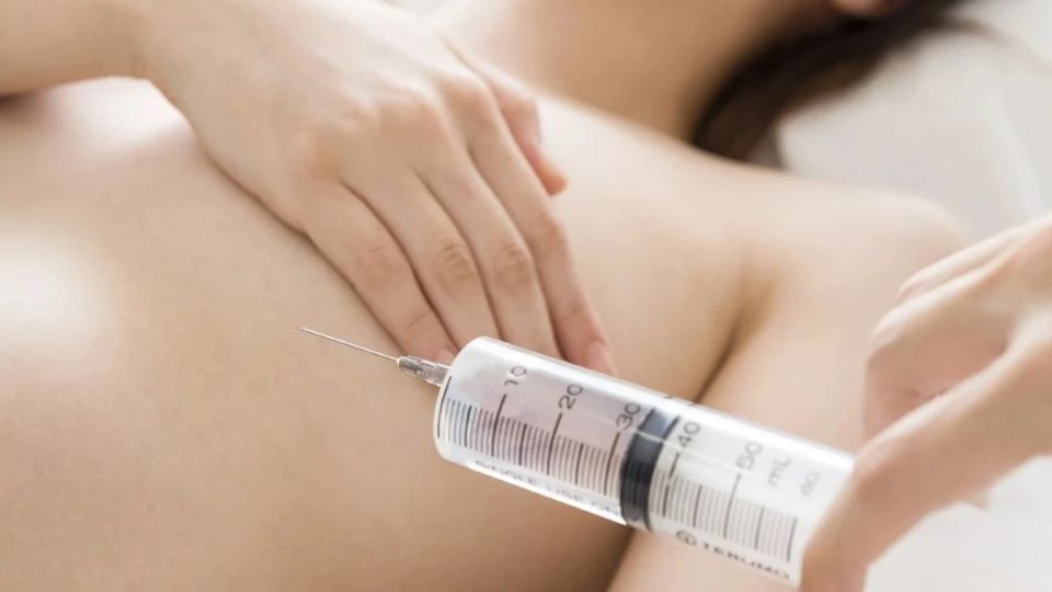 Người phụ nữ bị biến dạng vòng 1 sau tiêm filler làm đẹp