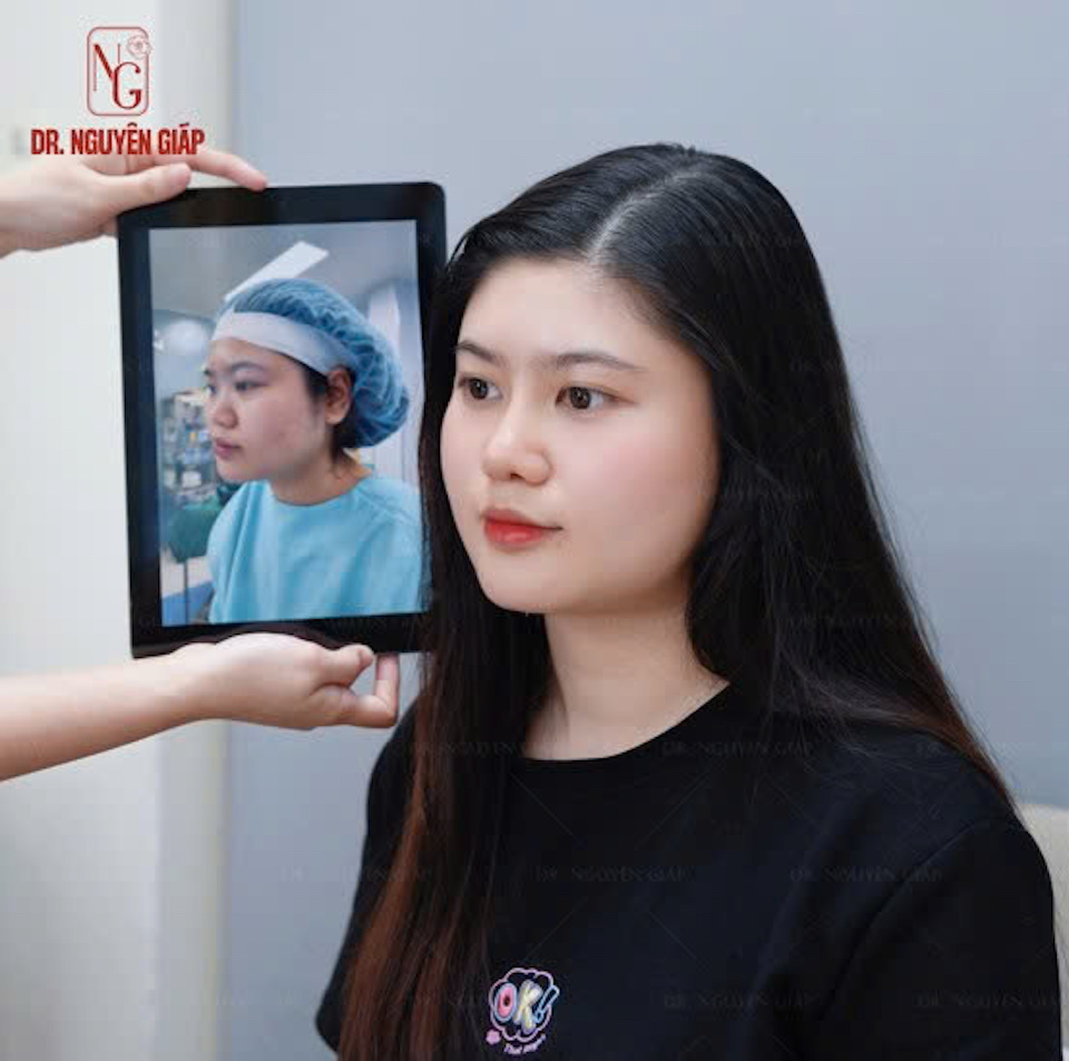 Xu hướng làm đẹp hiện nay qua phân tích chuyên môn của Bác sĩ Nguyên Giáp