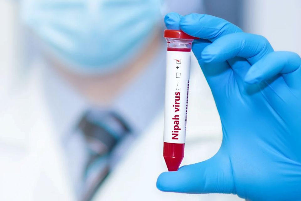 Quy trình xét nghiệm và xác định ca bệnh nhiễm virus Nipah theo hướng dẫn mới