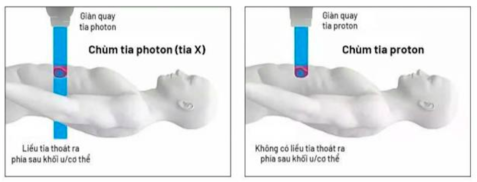 Tổng Bí thư Tô Lâm chứng kiến lễ ký kết "siêu máy" Proton: Đưa y tế Việt Nam vươn tầm thế giới